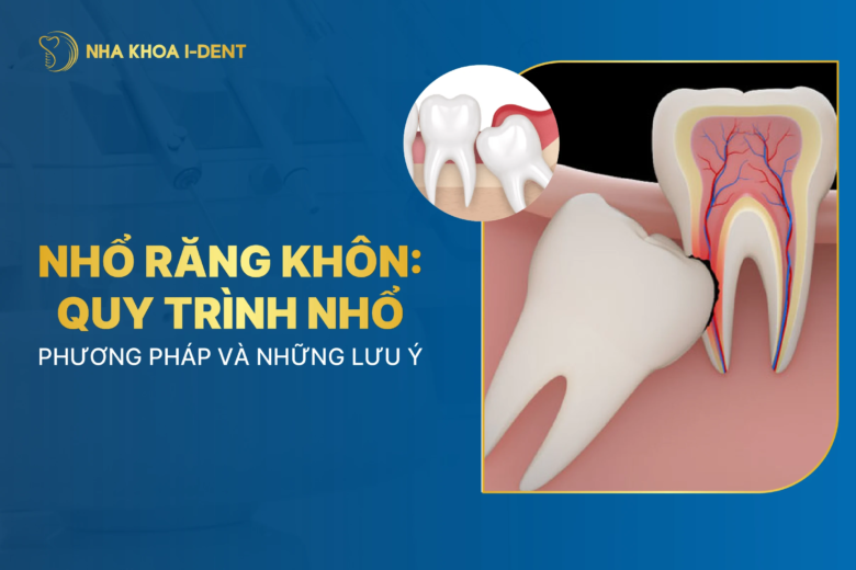 Quy trình nhổ răng khôn: Các bước thực hiện và lưu ý