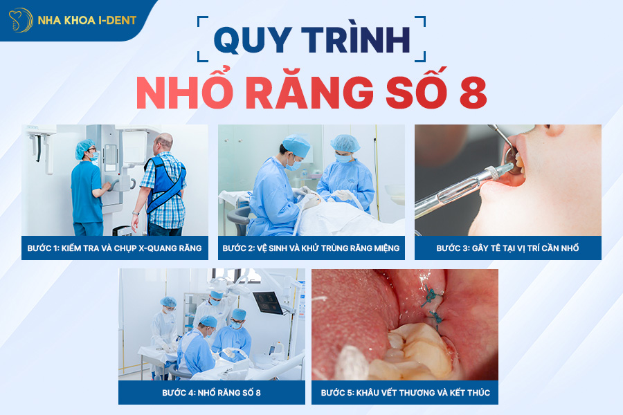 nhổ răng số 8 có đau không