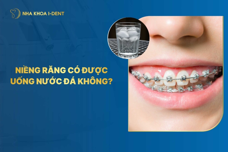 Đang niềng răng có được uống nước đá không? Tác hại gì?