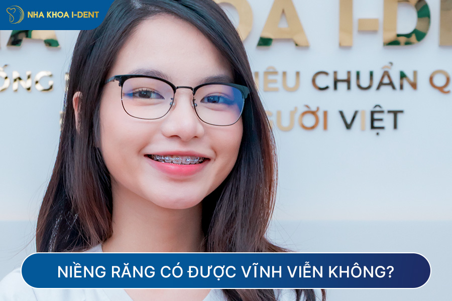 niềng răng có được vĩnh viễn không