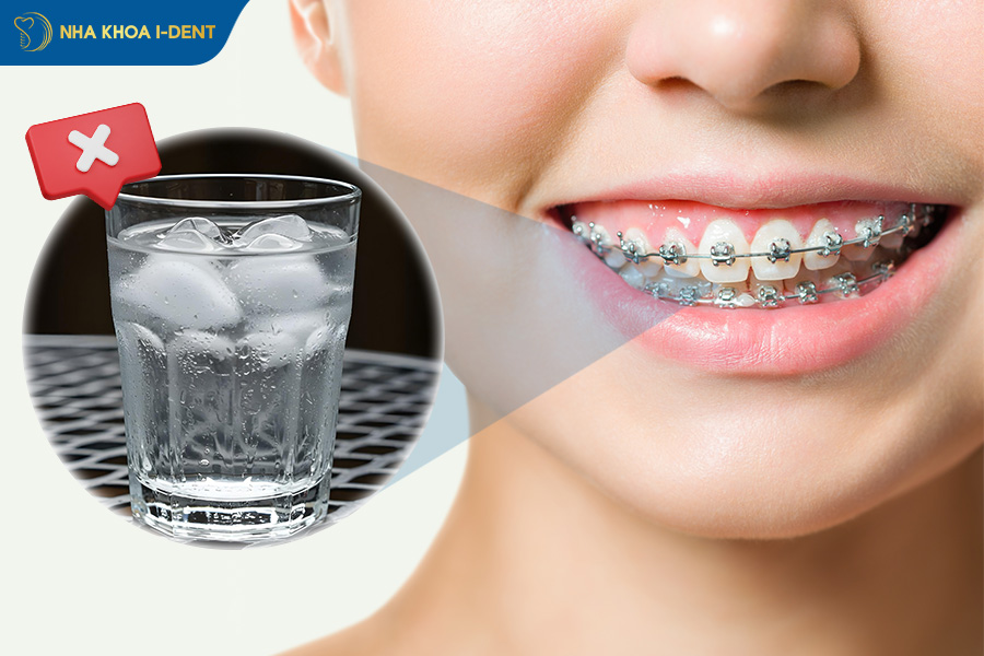 niềng răng có được uống nước đá không