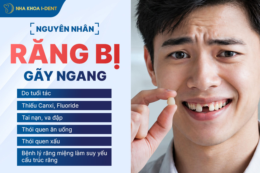 răng bị gãy ngang phải làm sao